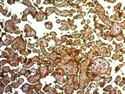 Alkaline Phosphatase/ALPP Antibody (SPM593), Novus Biologicals 0.2mg; Unlabeled:Antibodies,